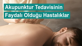 Akupunktur Tedavisinin Faydalı Olduğu Hastalıklar