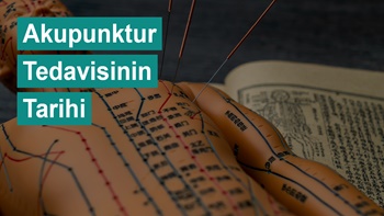 Akupunktur Tedavisinin Tarihi