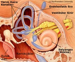 Meniere mn5