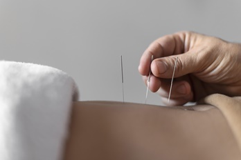 Akupunktur Tedavisinden Fayda Gören Hastalıklar